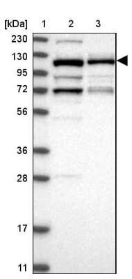 Western Blot: VPS50 Antibody [NBP1-88012] - Lane 1: Marker  [kDa] 230, 130, 95, 72, 56, 36, 28, 17, 11.  Lane 2: Human cell line RT-4.  Lane 3: Human cell line U-251MG sp