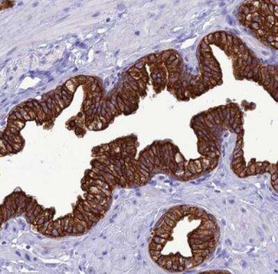 Immunohistochemistry: VPS52 Antibody [NBP2-30418] - Staining of human prostate shows strong cytoplasmic and membranous positivity in glandular cells.