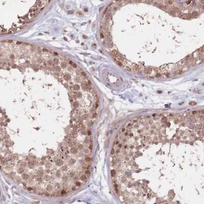 Immunohistochemistry-Paraffin: VPS52 Antibody [NBP2-30721] - Staining of human testis shows cytoplasmic and nuclear positivity in cells in seminiferous ducts.