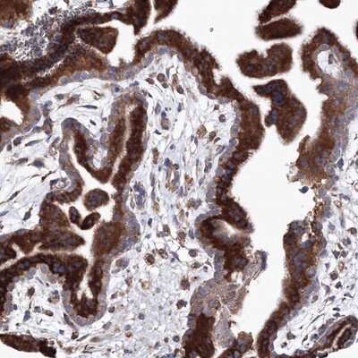 Immunohistochemistry-Paraffin: VPS8 Antibody [NBP1-82007] - Staining of human placenta shows strong cytoplasmic positivity in trophoblastic cells.