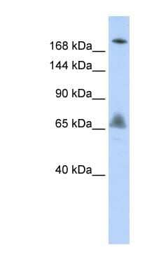 Western Blot: VPS8 Antibody [NBP1-55274] - HepG2 cell lysate, concentration 0.2-1 ug/ml.