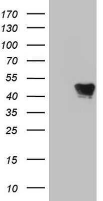 Western Blot: VRK1 Antibody (2C9) [NBP2-46351] - Analysis of HEK293T cells were transfected with the pCMV6-ENTRY control (Left lane) or pCMV6-ENTRY VRK1.