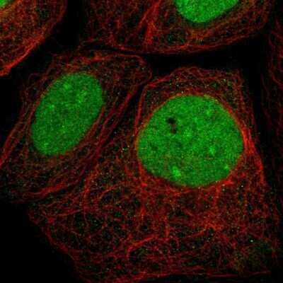 Immunocytochemistry/Immunofluorescence: VRK1 Antibody [NBP1-89548] - Staining of human cell line A-431 shows positivity in nucleus and nucleoli.