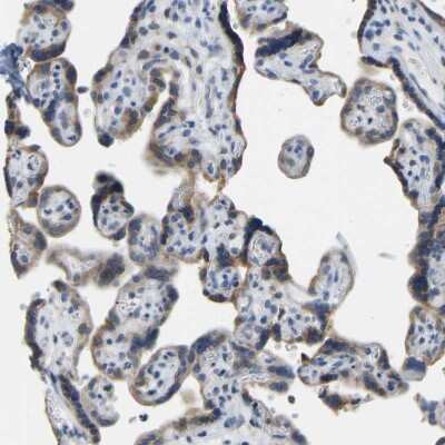 Immunohistochemistry: VRK1 Antibody [NBP1-89548] - Staining of human placenta shows moderate cytoplasmic positivity in trophoblastic cells.