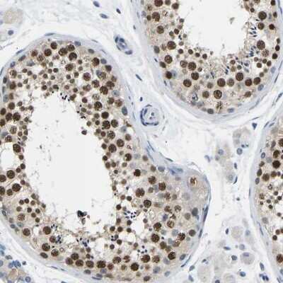 Immunohistochemistry-Paraffin: VRK1 Antibody [NBP1-89548] - Staining of human testis shows strong nuclear positivity in cells of seminiferus ducts.