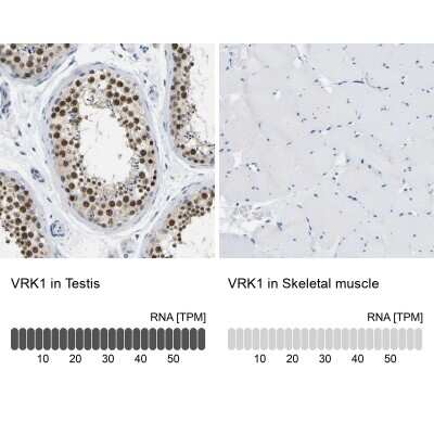 Immunohistochemistry-Paraffin: VRK1 Antibody [NBP1-89548] - Analysis in human testis and skeletal muscle tissues. Corresponding VRK1 RNA-seq data are presented for the same tissues.