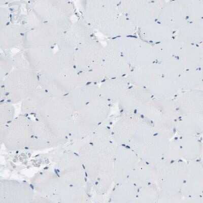 Immunohistochemistry-Paraffin: VRK1 Antibody [NBP1-89548] - Staining of human skeletal muscle shows no positivity in myocytes as expected.