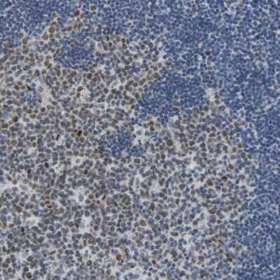 Immunohistochemistry-Paraffin: VRK1 Antibody [NBP1-89548] - Staining of human tonsil shows moderate nuclear positivity in germinal center cells.