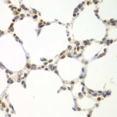 Immunohistochemistry-Paraffin: VRK1 Antibody [NBP2-93500] - Paraffin-embedded mouse lung using VRK1 .