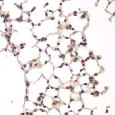 Immunohistochemistry-Paraffin: VRK1 Antibody [NBP2-93500] - Paraffin-embedded rat lung using VRK1 .