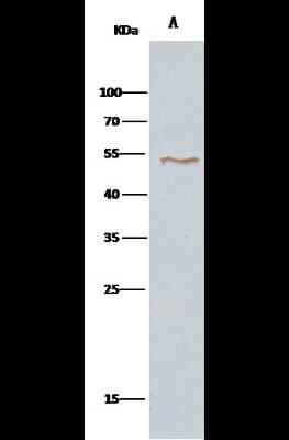 Immunoprecipitation: VRK1 Antibody [NBP2-99819] - VRK1 was immunoprecipitated using: Lane A: 0.5 mg Hela Whole Cell Lysate 2 ul anti-VRK1 rabbit polyclonal antibody and 15 ul of 50 % Protein G agarose. Primary antibody: Anti-VRK1 rabbit polyclonal antibody, at 1:100 dilution. Secondary antibody: Clean-Bloto IP Detection Reagent (HRP) at 1:1000 dilution. Developed using the DAB staining technique. Performed under reducing conditions. Predicted band size: 45 kDa. Observed band size: 45 kDa