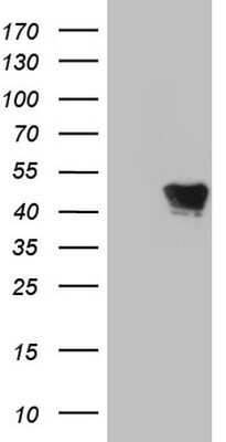 Western Blot: VRK1 Antibody (OTI2C9) - Azide and BSA Free [NBP2-74855] - Analysis of HEK293T cells were transfected with the pCMV6-ENTRY control (Left lane) or pCMV6-ENTRY VRK1.