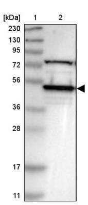 Western Blot: VRK1 Antibody [NBP1-89548] - Lane 1: Marker  [kDa] 230, 130, 95, 72, 56, 36, 28, 17, 11.  Lane 2: Human cell line RT-629