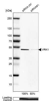 Western Blot: VRK1 Antibody [NBP1-89548] - Analysis in Rh30 cells transfected with control siRNA, target specific siRNA probe #1, using Anti-VRK1 antibody. Remaining relative intensity is presented. Loading control: Anti-PPIB.