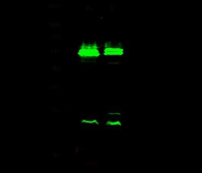 Western Blot: VRK1 Antibody [NBP2-99819] - Anti-VRK1 rabbit polyclonal antibody at 1:500 dilution. Lane A: 293T Whole Cell Lysate. Lane B: Hela Whole Cell Lysate. Lysates/proteins at 30 ug per lane. Secondary Goat Anti-Rabbit IgG H&L (Dylight 800) at 1/10000 dilution. Developed using the Odyssey technique. Performed under reducing conditions. Predicted band size: 45 kDa. Observed band size: 54 kDa (We are unsure as to the identity of these extra bands).