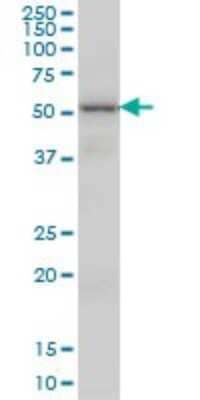 Western Blot: VRK2 Antibody (3B10) [H00007444-M01] - VRK2 monoclonal antibody (M01), clone 3B10 Analysis of VRK2 expression in K-562.