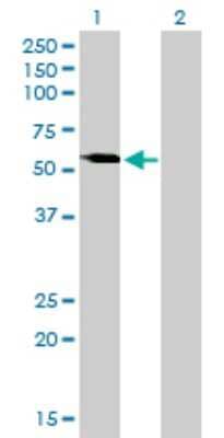 Western Blot: VRK2 Antibody (3B10) [H00007444-M01] - Analysis of VRK2 expression in transfected 293T cell line by VRK2 monoclonal antibody (M01), clone 3B10.Lane 1: VRK2 transfected lysate(58.1 KDa).Lane 2: Non-transfected lysate.