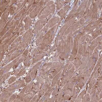 Immunohistochemistry-Paraffin: VRK2 Antibody [NBP2-48875] - Staining of human heart shows moderate cytoplasmic positivity in cardiomyocytes.