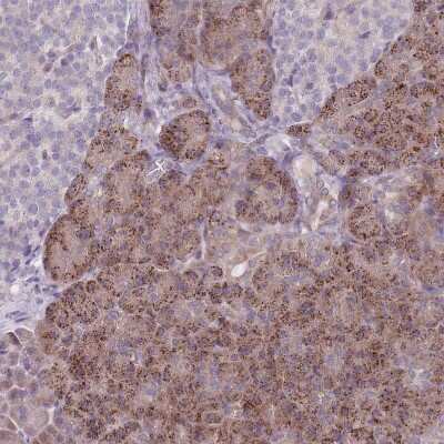 Immunohistochemistry-Paraffin: VRK2 Antibody [NBP2-48875] - Staining of human pancreas shows moderate granular cytoplasmic positivity in exocrine glandular cells.