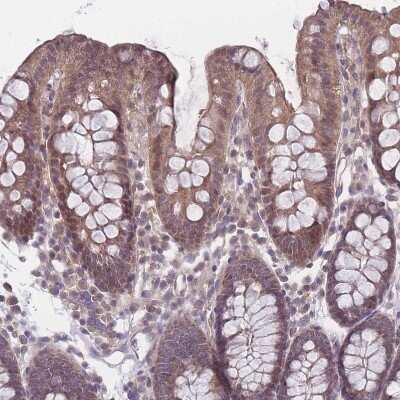 Immunohistochemistry-Paraffin: VRK2 Antibody [NBP2-48875] - Staining of human colon shows moderate cytoplasmic positivity in glandular cells.