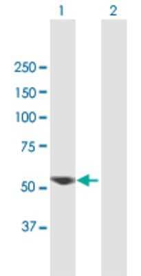 Western Blot: VRK2 Antibody [H00007444-B01P] - Analysis of VRK2 expression in transfected 293T cell line by VRK2 polyclonal antibody.  Lane 1: VRK2 transfected lysate(55.88 KDa). Lane 2: Non-transfected lysate.