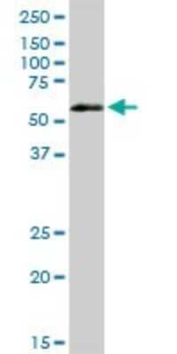Western Blot VRK2 Antibody - Azide and BSA Free