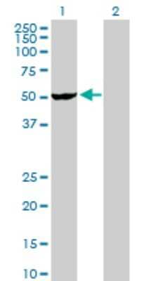 Western Blot: VRK2 Antibody [H00007444-D01P] - Analysis of VRK2 expression in transfected 293T cell line by VRK2 polyclonal antibody.Lane 1: VRK2 transfected lysate(58.10 KDa).Lane 2: Non-transfected lysate.
