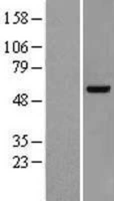 Western Blot VRK2 Overexpression Lysate