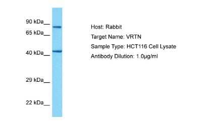 Western Blot: VRTN Antibody [NBP2-83757] - Host: Rabbit. Target Name: VRTN. Sample Tissue: Human HCT116 Whole Cell. Antibody Dilution: 1ug/ml