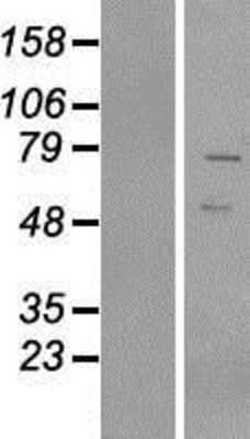 Western Blot: VRTN Overexpression Lysate (Adult Normal) [NBP2-06846] Left-Empty vector transfected control cell lysate (HEK293 cell lysate); Right -Over-expression Lysate for VRTN.