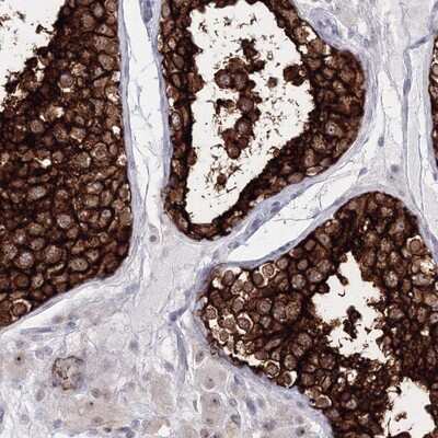 Immunohistochemistry-Paraffin: VSIG1 Antibody [NBP1-81072] - Staining of human testis shows strong cytoplasmic and membranous positivity in cells in seminiferus ducts.