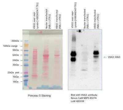 Western Blot: VSIG1 Antibody [NBP1-81074] - Analysis in denatured VSIG1 overexpression lysate (Cat. # H00340547-T01, left), vector only transfected lysate (center) and native VSIG1 overexpression lysate (Cat. # NBL1-17761, right). Image submitted by a verified customer review. 
