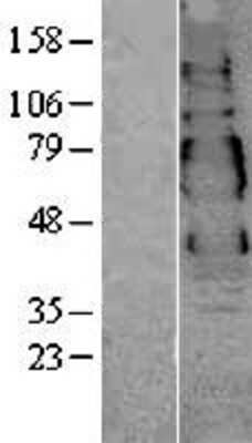 Western Blot: VSIG1 Overexpression Lysate (Adult Normal) [NBL1-17761] Left-Empty vector transfected control cell lysate (HEK293 cell lysate); Right -Over-expression Lysate for VSIG1.