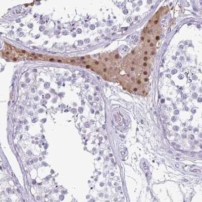 Immunohistochemistry-Paraffin VSIG10L Antibody - BSA Free