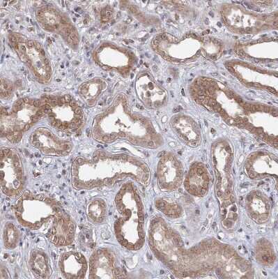 Immunohistochemistry-Paraffin: VSIG2 Antibody [NBP1-84338] - Staining of human kidney shows moderate membranous positivity in cells in tubules.