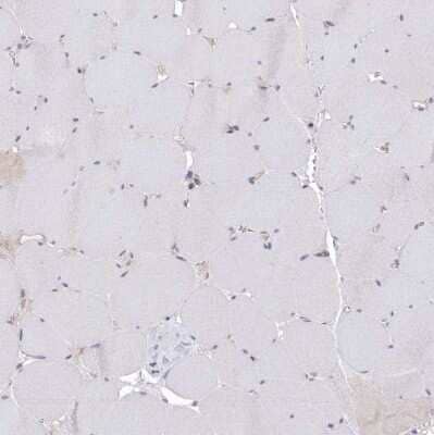 Immunohistochemistry-Paraffin: VSIG2 Antibody [NBP1-84338] - Staining of human skeletal muscle shows no positivity in myocytes as expected.