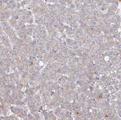 Immunohistochemistry-Paraffin: VSIG2 Antibody [NBP1-84338] - Staining of human liver shows moderate membranous positivity in hepatocytes.