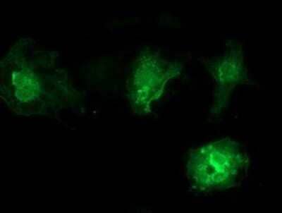 Immunocytochemistry/Immunofluorescence: VSIG2 Antibody (OTI2D8) - Azide and BSA Free [NBP2-74858] - Staining of COS7 cells transiently transfected by pCMV6-ENTRY VSIG2.