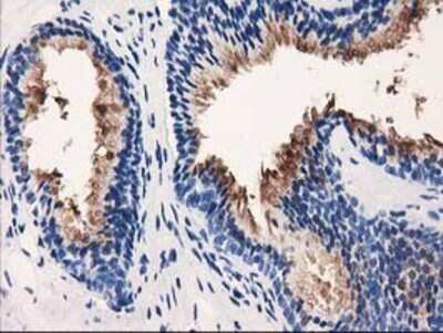 Immunohistochemistry: VSIG2 Antibody (OTI2D8) - Azide and BSA Free [NBP2-74858] - Staining of paraffin-embedded Human prostate tissue using anti-VSIG2 mouse monoclonal antibody.