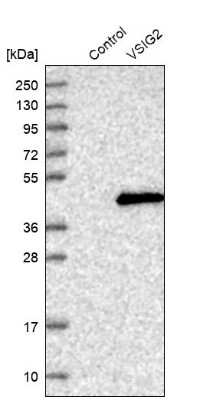 Western Blot: VSIG2 Antibody [NBP1-84338] - Analysis in control (vector only transfected HEK293T lysate) and VSIG2 over-expression lysate (Co-expressed with a C-terminal myc-DDK tag (3.1 kDa) in mammalian HEK293T cells).
