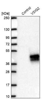 <b>Orthogonal Strategies Validation. </b>Western Blot: VSIG2 Antibody [NBP2-48955] - Analysis in control (vector only transfected HEK293T lysate) and VSIG2 over-expression lysate (Co-expressed with a C-terminal myc-DDK tag (3.1 kDa) in mammalian HEK293T cells).