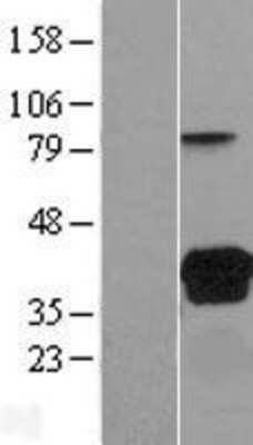 Western Blot VSIG2 Overexpression Lysate