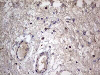 Immunohistochemistry: VSIG3/IGSF11 Antibody (OTI2H1) - Azide and BSA Free [NBP2-74861] - Analysis of Human bladder tissue.