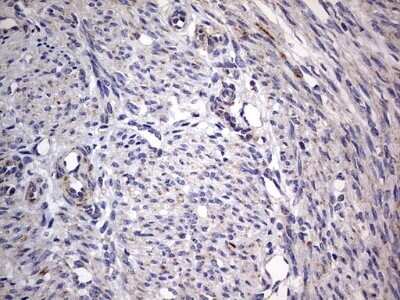 Immunohistochemistry: VSIG3/IGSF11 Antibody (OTI2H1) - Azide and BSA Free [NBP2-74861] - Analysis of Human endometrium tissue.