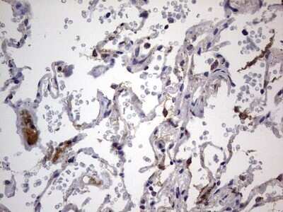 Immunohistochemistry: VSIG3/IGSF11 Antibody (OTI2H1) - Azide and BSA Free [NBP2-74861] - Analysis of Human lung tissue.