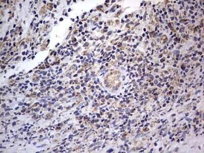 Immunohistochemistry: VSIG3/IGSF11 Antibody (OTI2H1) - Azide and BSA Free [NBP2-74861] - Analysis of Human lymph node tissue.