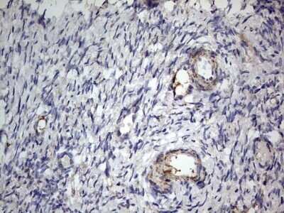 Immunohistochemistry: VSIG3/IGSF11 Antibody (OTI2H1) - Azide and BSA Free [NBP2-74861] - Analysis of Human Ovary tissue. Dilution: 1:150