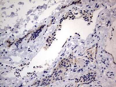 Immunohistochemistry: VSIG3/IGSF11 Antibody (OTI2H1) - Azide and BSA Free [NBP2-74861] - Analysis of Human thyroid tissue. Dilution: 1:150