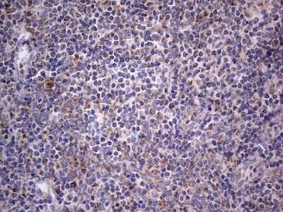 Immunohistochemistry: VSIG3/IGSF11 Antibody (OTI2H1) - Azide and BSA Free [NBP2-74861] - Analysis of Human tonsil tissue.