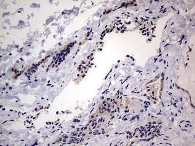 Immunohistochemistry: VSIG3/IGSF11 Antibody (OTI2H1) [NBP2-46046] - Analysis of Human thyroid tissue.  Dilution: 1:150